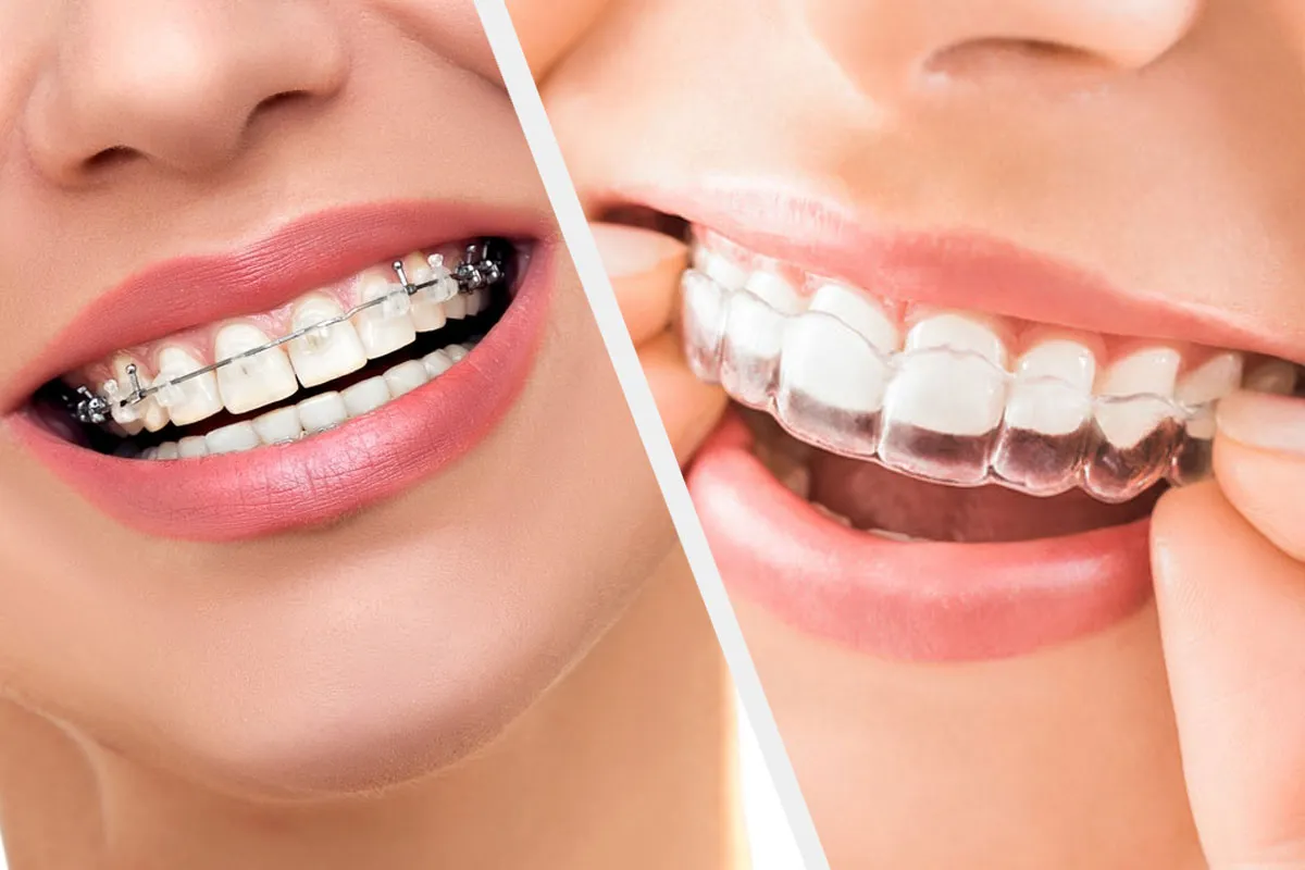 Orthodontie